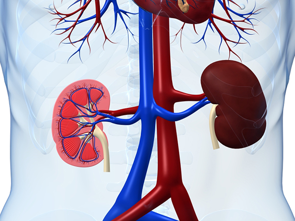 KidneyDiseaseAndDiet